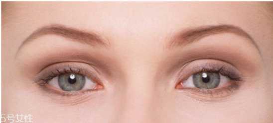 黑眼圈严重怎么去除