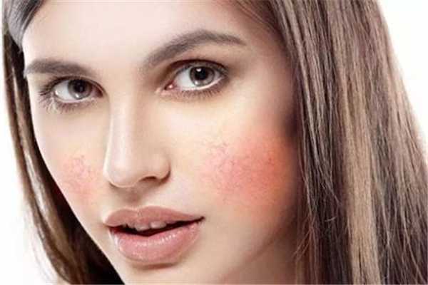 敏感肌脸部发红怎么修复 敏感肌怎么修复成正常肌肤