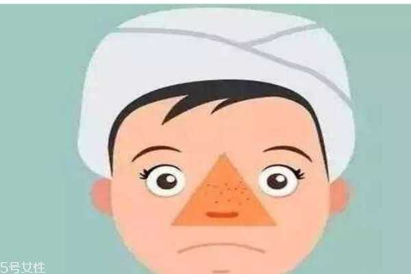 油皮怎么护肤呢