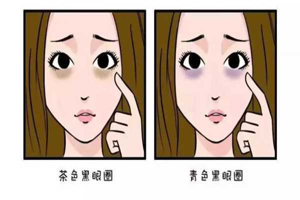 黑眼圈用鸡蛋敷有用吗 黑眼圈可以用鸡蛋敷吗