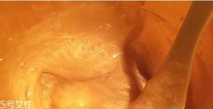 香蒲丽黄金面膜可以分两次用吗