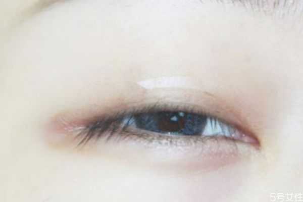 三眼皮怎样贴双眼皮贴？多层眼皮怎么贴双眼皮贴