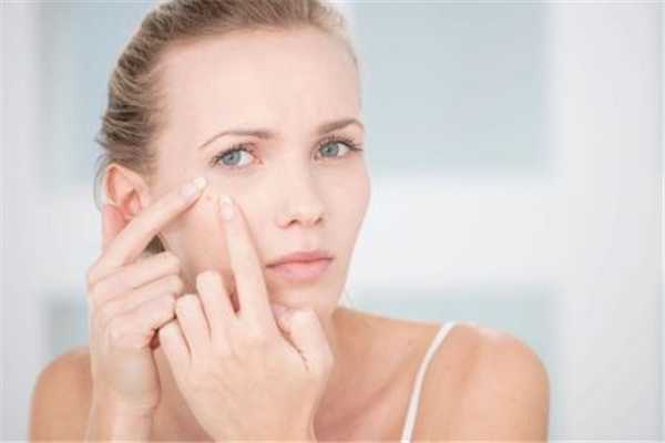 夏天脸上长痘痘怎么回事?为什么夏天脸上爱长痘 夏天脸上长痘痘怎么回事?为什么夏天脸上爱长痘