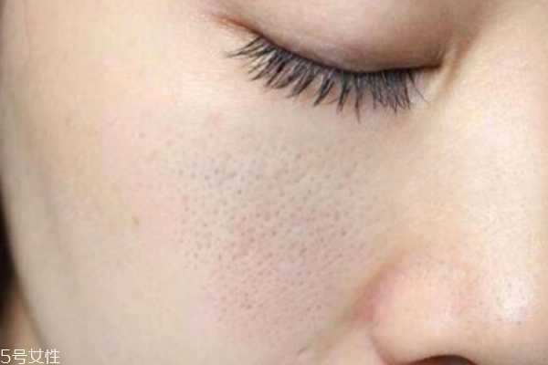 毛孔粗大用什么精华液 毛孔粗大用什么精华液