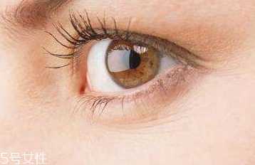 眼角细纹是什么原因