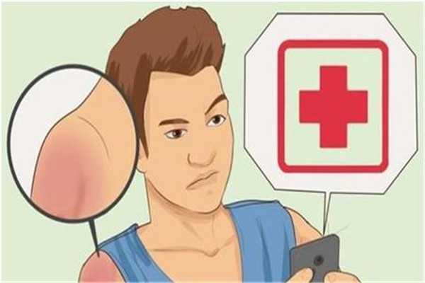 晒伤是什么感觉