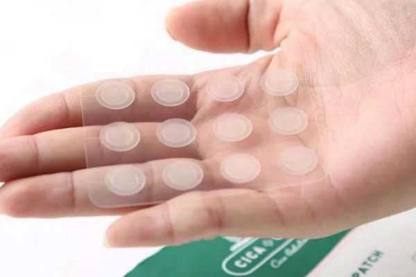 什么样的痘痘才适合用痘痘贴