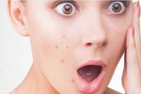 芙清凝胶怎么使用