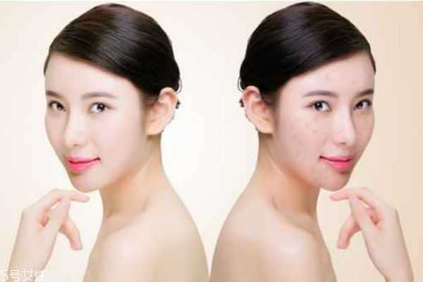 脸上毛孔很大的女生怎样化妆好看?怎样化妆隐形毛孔 脸上毛孔很大的女生怎样化妆好看?怎样化妆隐形毛孔