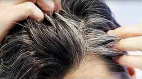 女人前额白发多是缺什么？女人前额白发吃什么好