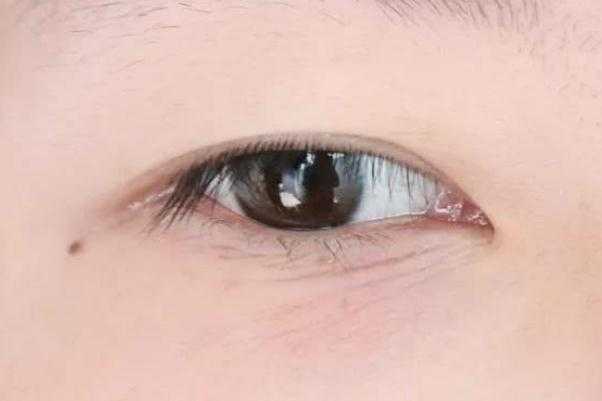 眼部细纹越来越多了怎么改善 眼部细纹松弛最好的解决办法