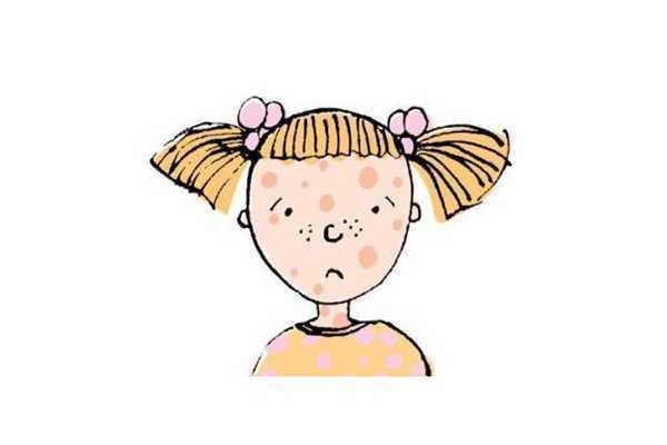 黄褐斑可以自己淡掉吗