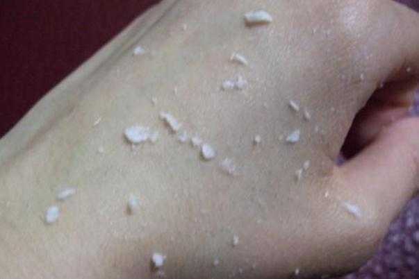 去角质要先卸妆吗？去角质要多久一次