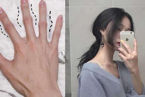 手指关节又粗又黑怎么办