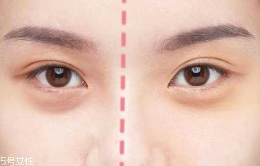 眼下遮瑕卡粉怎么办