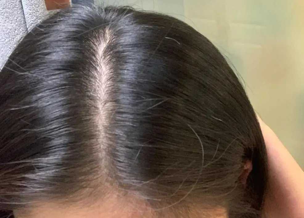 头发少，怎么发量怎么变多