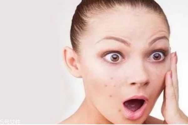 内分泌失调下巴长痘痘怎么调理