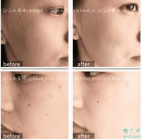 贝欧梦特谷胱甘肽美白精华怎么样 贝欧梦特谷胱甘肽美白精华怎么样