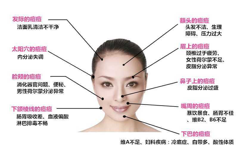 额头长痘的原因及解决方法