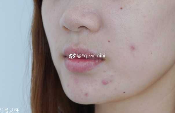 悦诗风吟小白管怎么用 悦诗风吟小白管怎么用