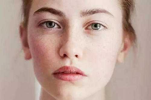 为什么女生会长麻子?女生长麻子的原因是什么 为什么女生会长麻子?女生长麻子的原因是什么