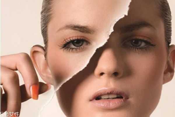 春季如何正确护肤 春季如何正确护肤