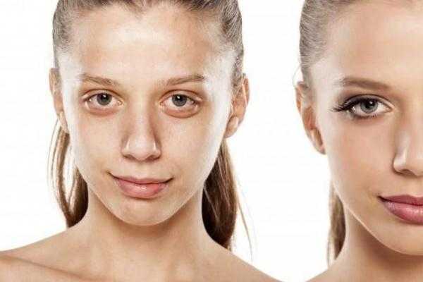 皮肤暗黄有斑怎么调理能变白？皮肤暗黄是身体哪里出了问题