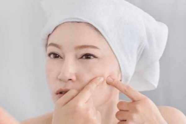 挤痘痘的坏处有什么？为什么不能挤痘痘