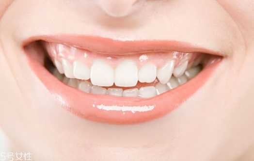 含氟牙膏能预防龋齿吗 氟化物能对抗龋齿