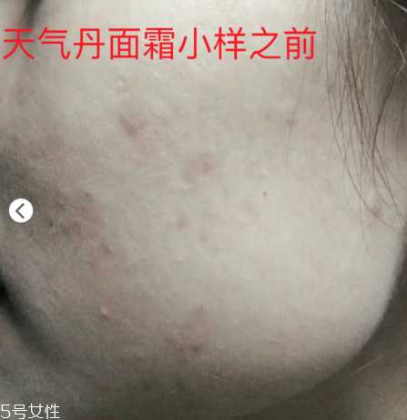 whoo后的天气丹效果怎么样？