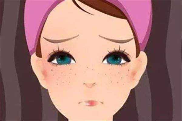 黄褐斑会不会传染?黄褐斑会不会越来越严重 黄褐斑会不会传染?黄褐斑会不会越来越严重