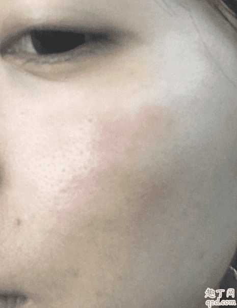 sk2神仙水用了为什么会刺痛？神仙水330ml瓶子里有水雾怎么回事