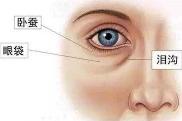 卧蚕和眼袋有什么区别 卧蚕和眼袋有什么区别
