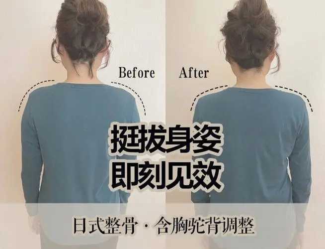 含胸驼背能用日式整骨矫正吗