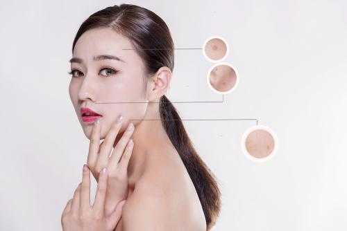 脸部死皮多是怎么回事?脸部死皮怎么去 脸部死皮多是怎么回事?脸部死皮怎么去