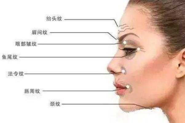 皱纹怎么样才能去掉 皱纹是什么原因造成的 皱纹怎么样才能去掉 皱纹是什么原因造成的