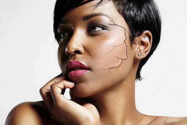 彩光嫩肤副作用 彩光嫩肤副作用