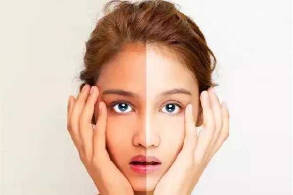 皮肤晒红了应该怎么处理