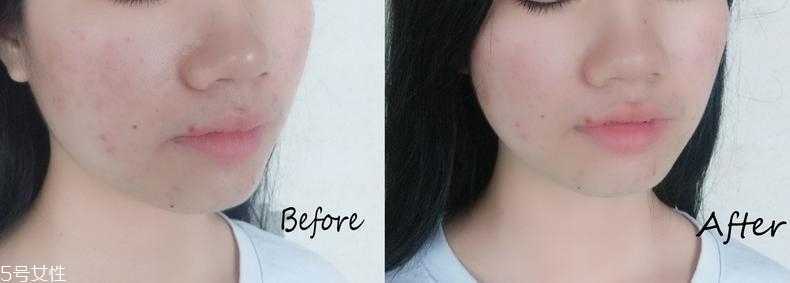 薇诺娜保湿面膜适合什么年龄 基础护肤的首选