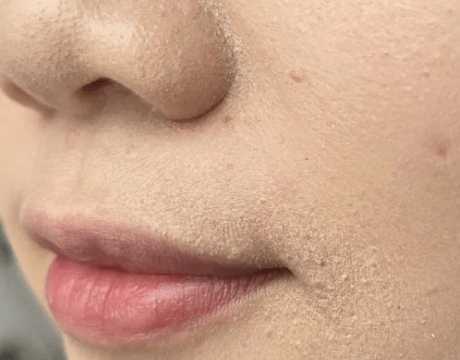 化妆浮粉严重怎么快速补救