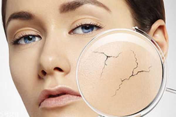 怎么修复皮肤屏障