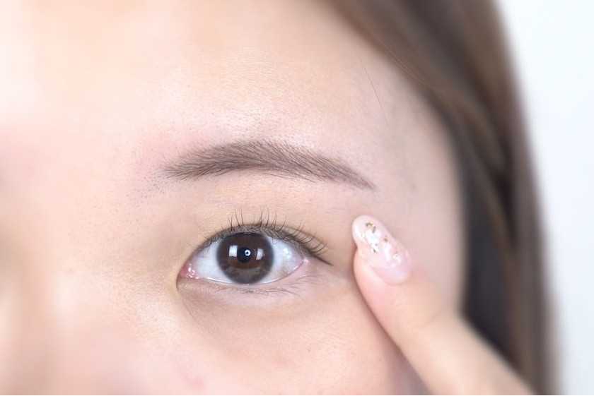 如何快速消除眼部浮肿