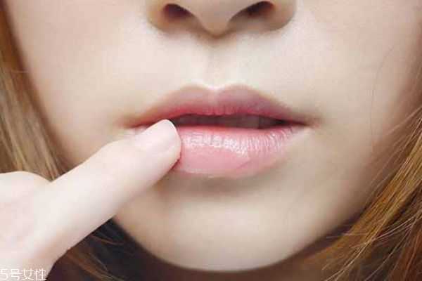 涂口红前的护理步骤 涂口红嘴巴干怎么办 涂口红前的护理步骤 涂口红嘴巴干怎么办