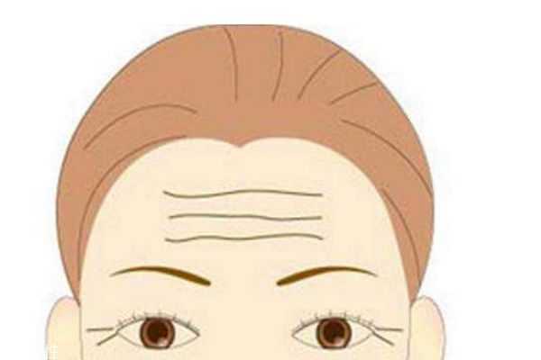 什么是抬头纹呢