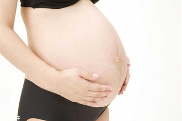 维生素e可以去妊娠纹吗