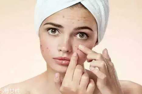 玫瑰精油怎么稀释？玫瑰精油需要稀释吗