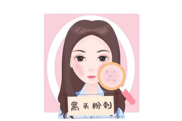 青春痘是什么样子的