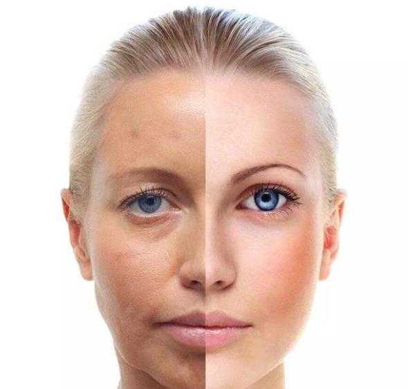 女生的腿为什么都很白?女的为什么比男的白 女生的腿为什么都很白?女的为什么比男的白