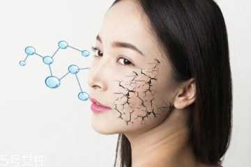 身体干燥用什么精油好？身体干燥怎么用精油