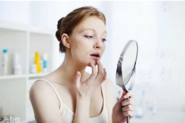 下巴反复长痘痘怎么治 下巴反复长痘痘怎么治